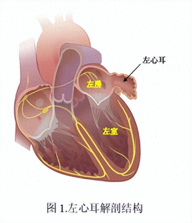 左心耳电隔离相比低电压区消融，并未改善房颤患者预后